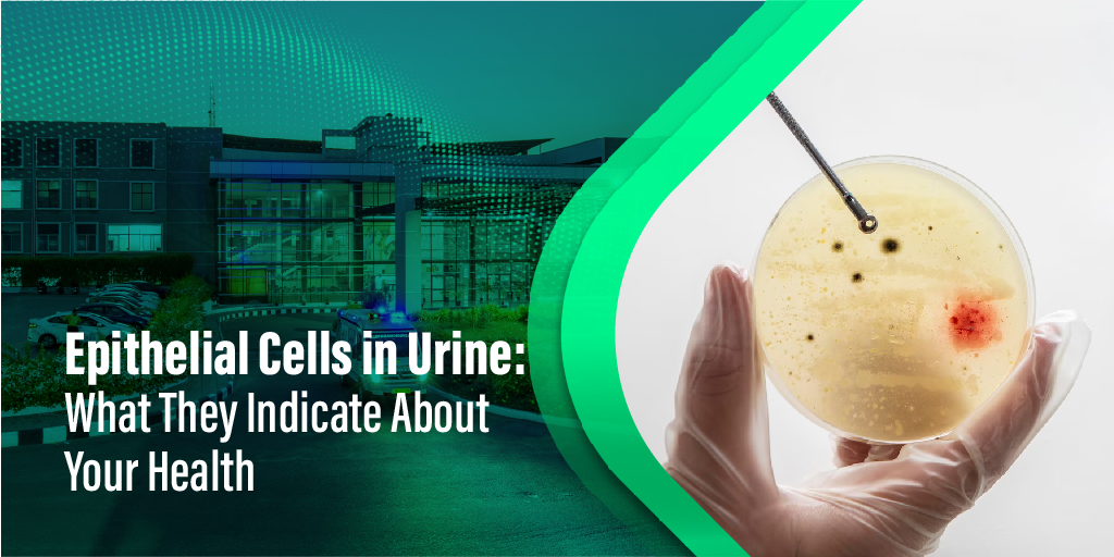 Epithelial Cells in Urine: What They Indicate About Your Health