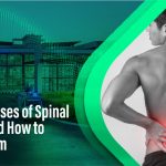 Common causes of spinal cord pain and effective management solutions.