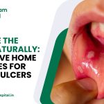 _Home Remedies for Mouth Ulcers_ Natural Cures for Quick Relief Home Remedies for Mouth Ulcers