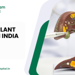 Liver transplant cost